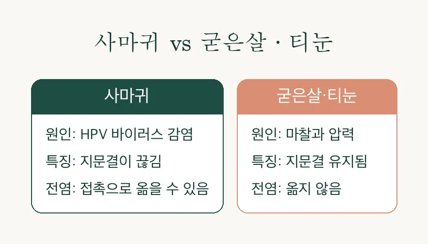 사마귀 냉동치료 받은 날 밤, 유독 욱신거리는 이유 관련 이미지 2