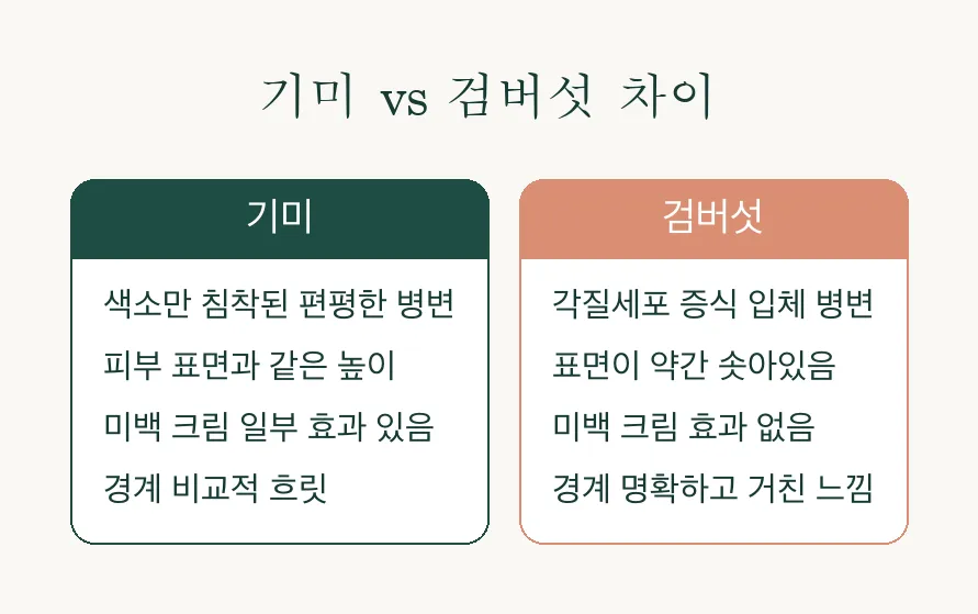 검버섯, 기미와 다른 이유부터 자가 관리법까지 정리 관련 이미지 3