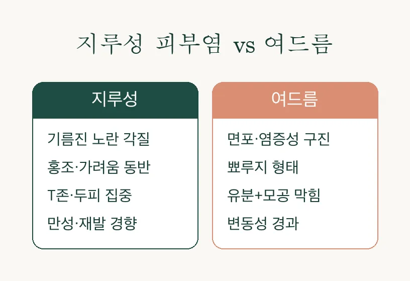 지루성 피부염, 원인부터 치료까지 알아보기 관련 이미지 3