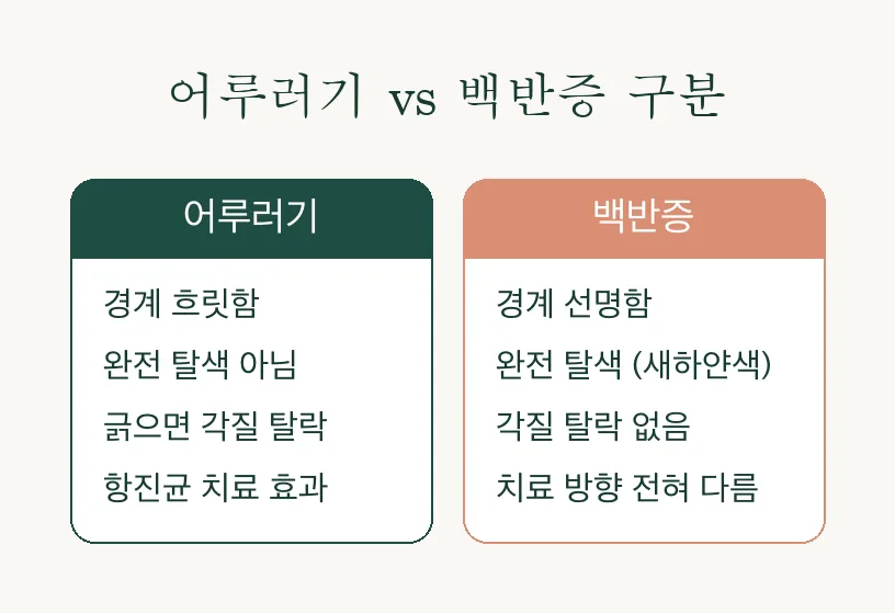 어루러기, 여름에 생기는 탈색반 원인부터 치료까지 관련 이미지 3