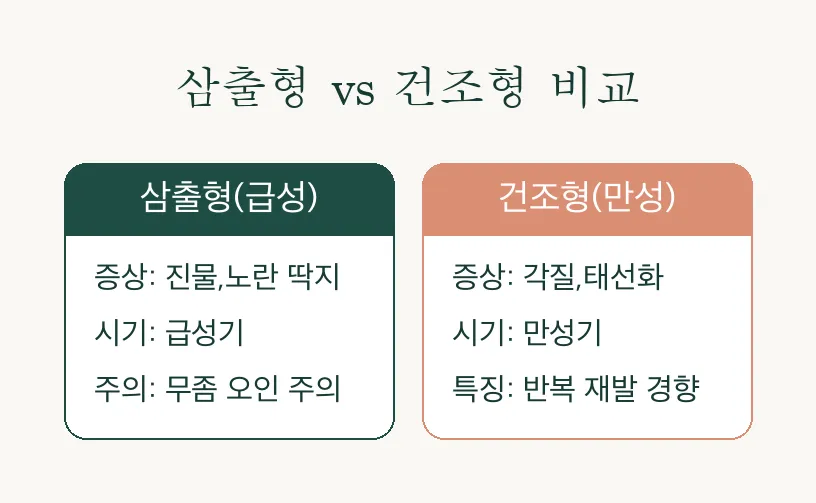 화폐상 습진 동전습진, 원인부터 치료까지 알아보기 관련 이미지 3